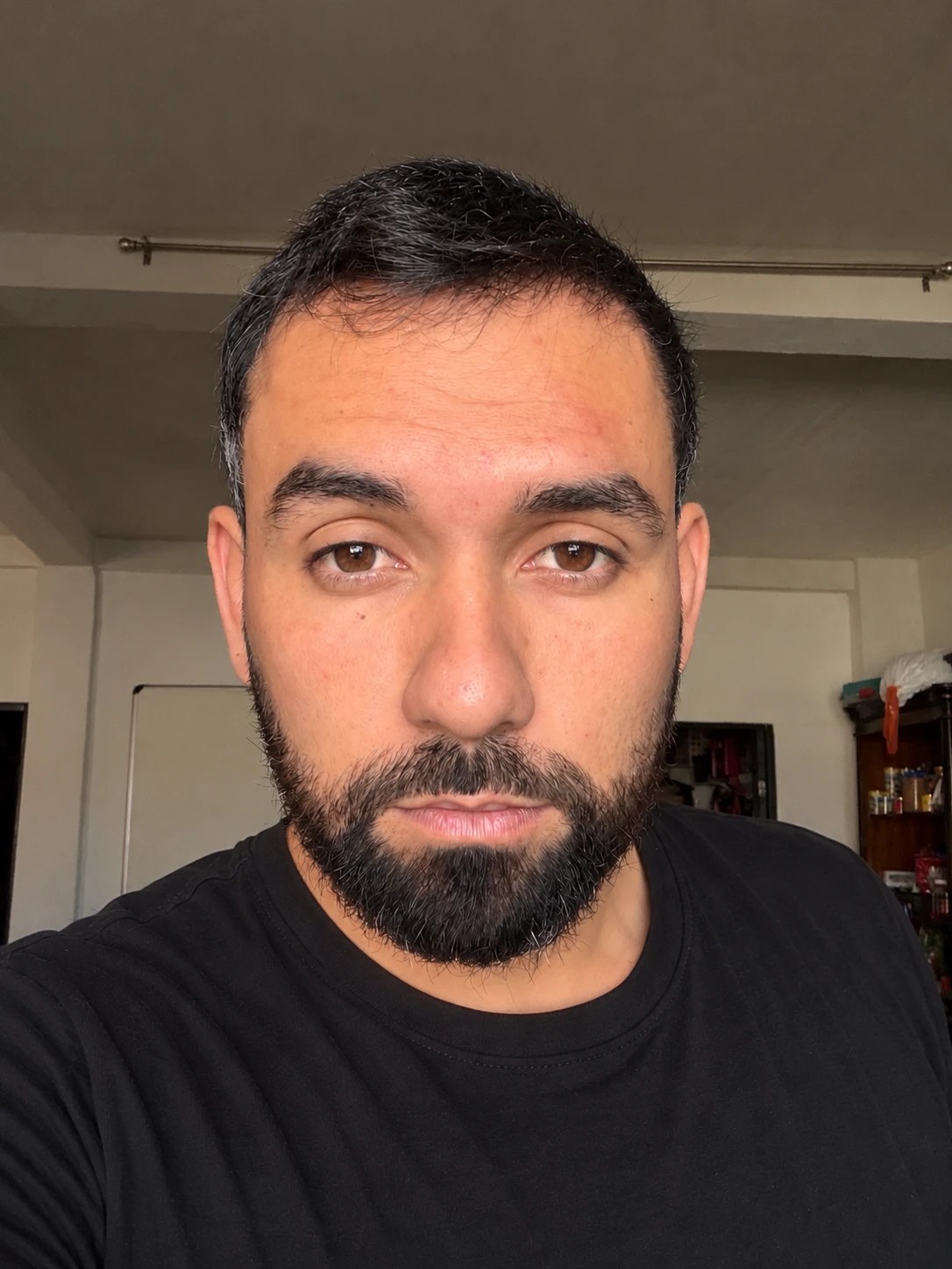 Josué hoy, de frente, con el cabello recuperado