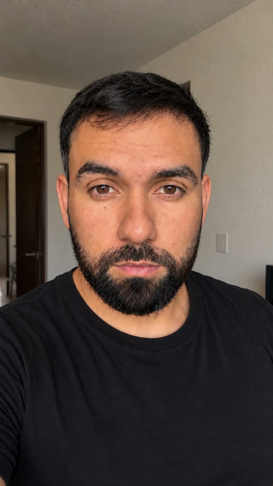 Josué hoy, de frente, con el cabello recuperado