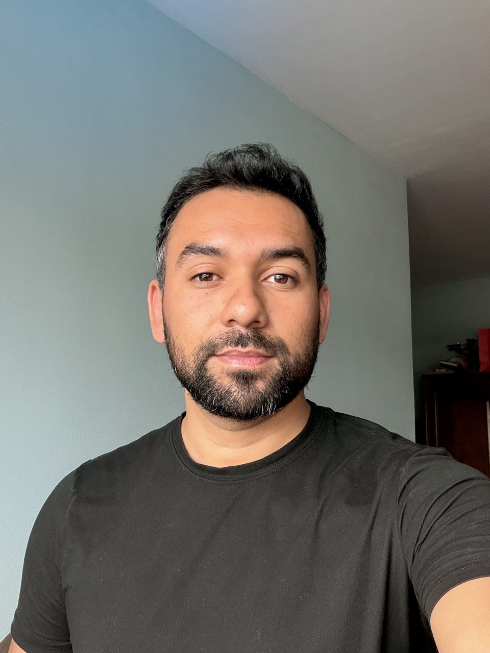 Josué hoy, 10 de agosto de 2026 — el cabello se mantiene 18 meses después
