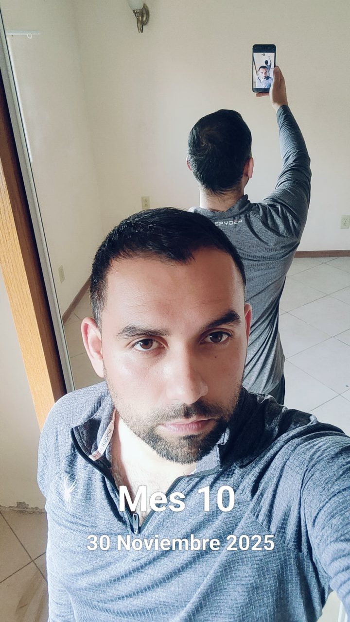 Mes 10 frente al espejo: cara y nuca en la misma foto