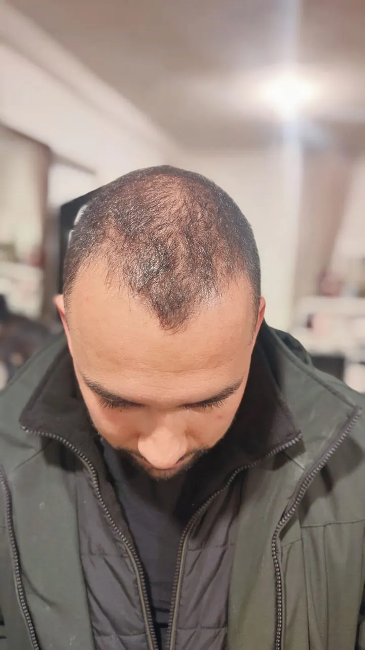 Josué en el Mes 0, antes de empezar la rutina